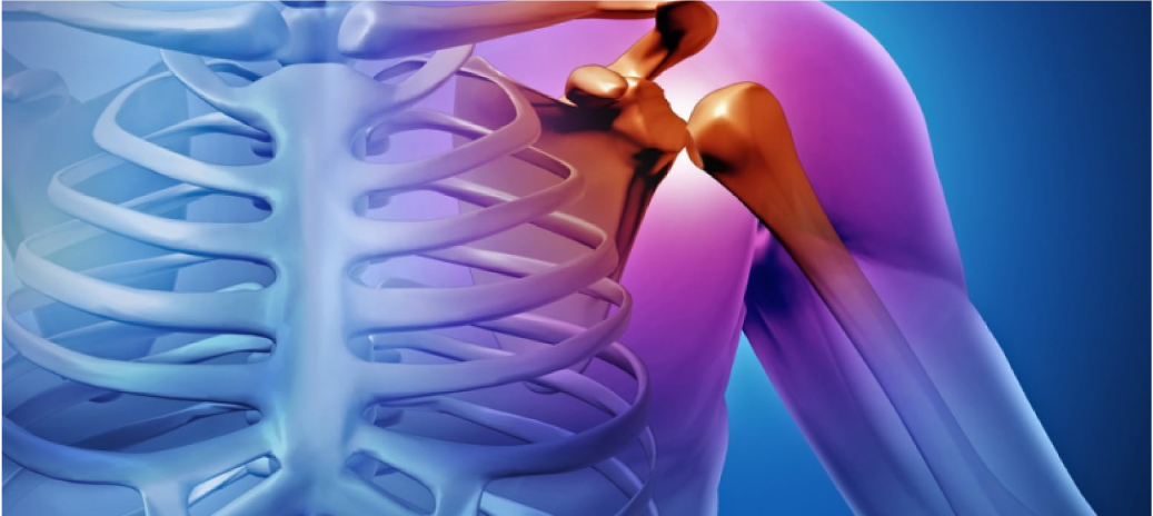 Tratamiento Integral de Fracturas